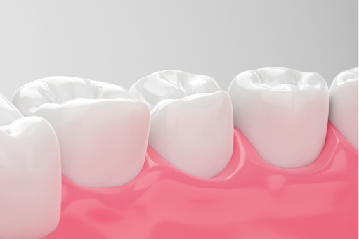 Fluoride Treatment